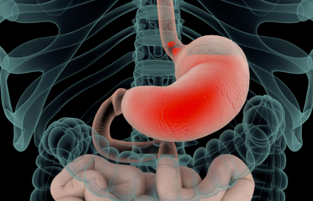 Digestion, Reflux and PPI's course image